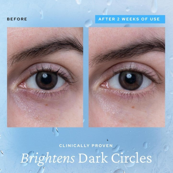 Korean Aqua Bomb Eye Gel - Niacinamide + Collagen Ceramic Tip Treatment